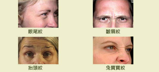 抬頭紋,皺眉紋,魚尾紋,兔寶寶紋